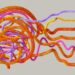 Autism and ADHD in eating disorder services: time to ask